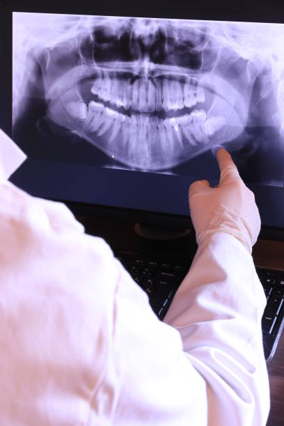 Best Emergency Treatment for Dental Infections or Abscesses in Tuscoosa, AL